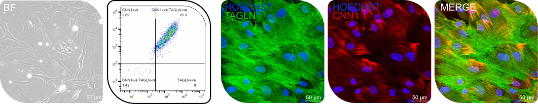 Lateral mesoderm-derived SMCs