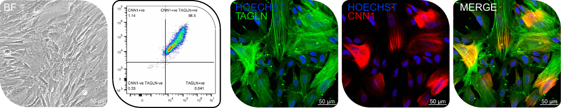 Paraxial mesoderm-derived SMCs
