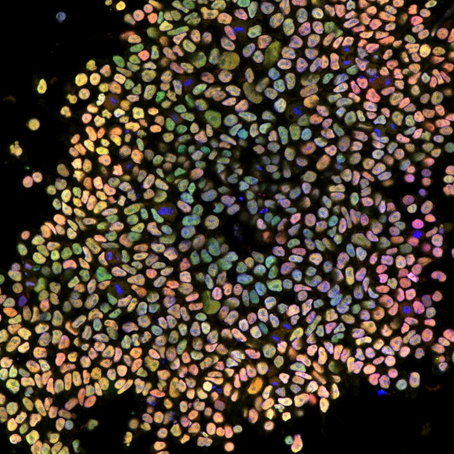 Image - Custom hiPSC reprogramming